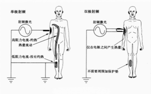 射頻美容儀,美容院美容設(shè)備,家用美容儀