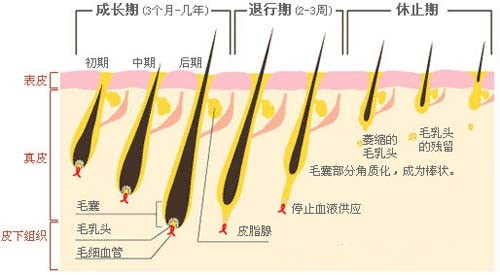 激光脫毛,808半導(dǎo)休脫毛機(jī),永久脫毛,無痛脫毛