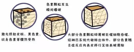 光子嫩膚,嫩膚方法,黑臉娃娃,光子嫩膚價(jià)格,家用美容儀