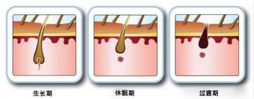 激光脫毛一次多少錢？能維持多久？