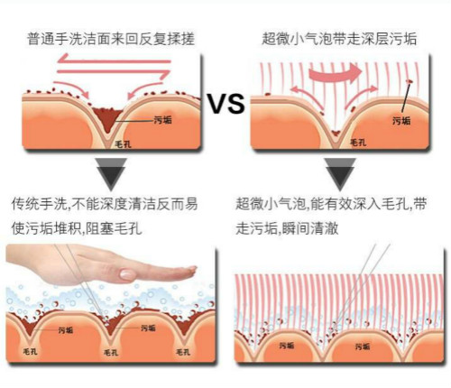 韓國超微小氣泡原理