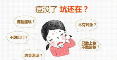 激光去痘印方法你適合嗎？